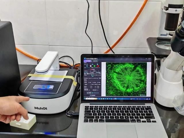 MCS21活細胞成像儀應用于上海華山醫院活細胞觀察.jpg MCS21活細胞成像儀應用于上海華山醫院活細胞觀察.jpg