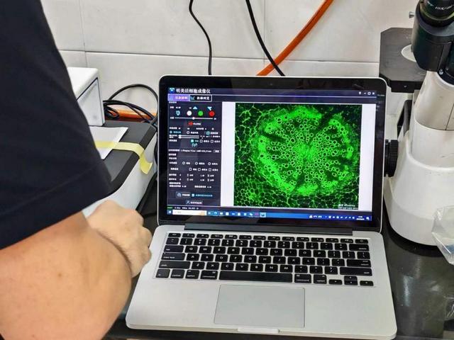 MCS21活細胞成像儀應用于上海華山醫院活細胞觀察.jpg MCS21活細胞成像儀應用于上海華山醫院活細胞觀察.jpg